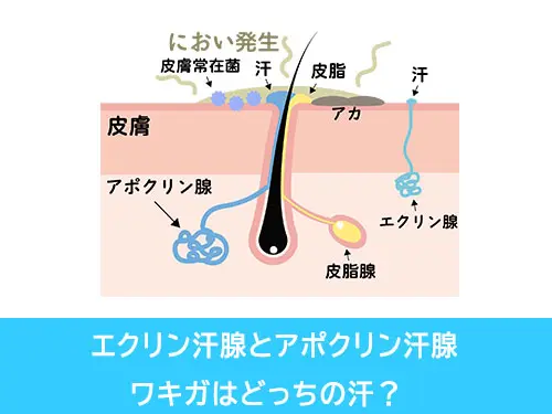 多汗症とワキガの違い02