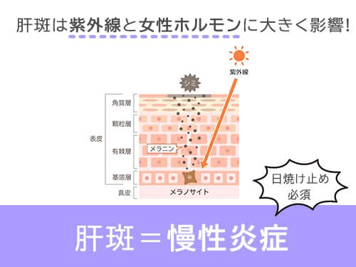 トラネキサム酸肝斑への効果03